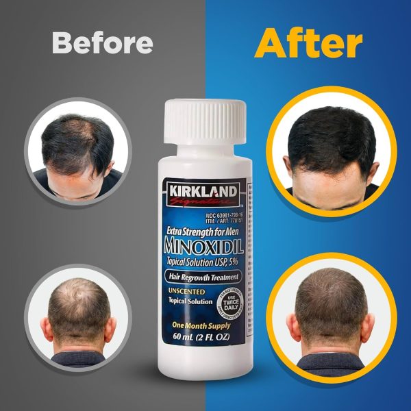 Minxidill Kirkland - 5% extra fuerte crecimiento - Imagen 3