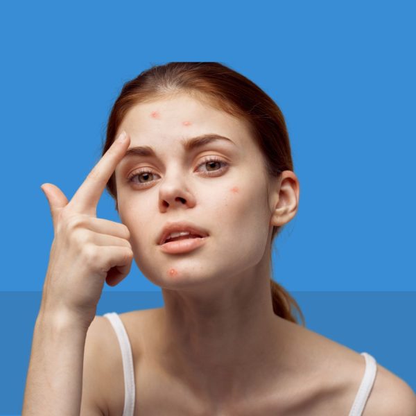 Dermatología
